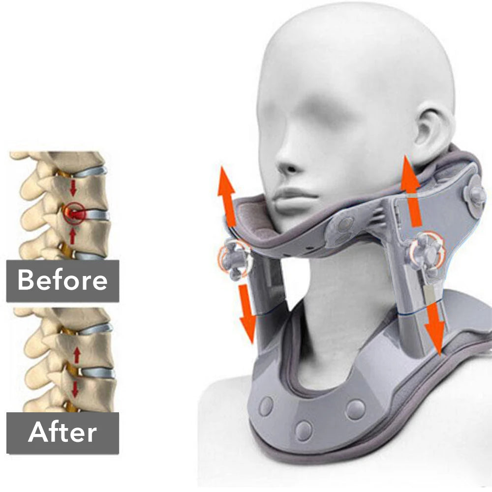 Medical Neck Traction Device Heating Inflatable Cervical Collar Correction Neck Retractor Cervical Collar Stretcher Corrector