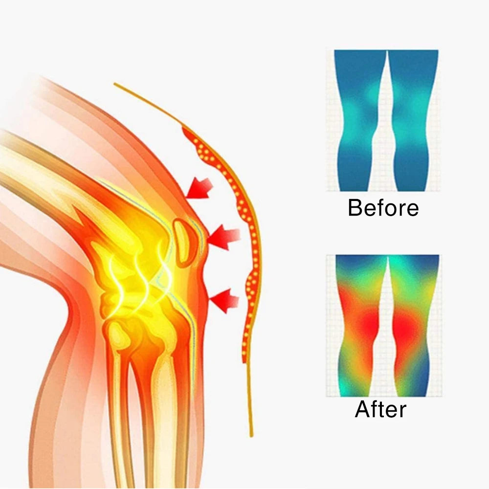 1 Pair Self Heating Knee Braces Sleeve Tourmaline Heated Knee Support Warm Knee Pads Patella Protect Sleeves Electric Heat Pad